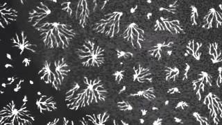 Pattern formation in slime mold Dictyostelium [upl. by Atinek]