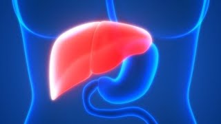 Diagnosis of Hepatocellular Carcinoma [upl. by Timrek999]