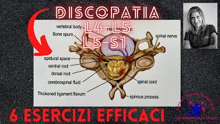 DISCOPATIA LOMBARE L4L5L5S1  6 ESERCIZI EFFICACI [upl. by Neomah115]