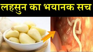 रात को सोते समय खाए लह्सुन 3 दिन में ही फ़र्क दिखने लगेगाgarlic health benefits [upl. by Quenby]