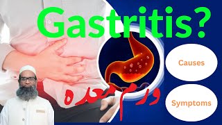 What is Gastritis Causes and Symptoms  Urdu  Hindi  Shahbaz Qamar [upl. by Caddric409]