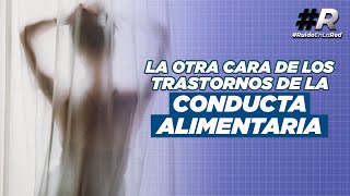 ¿Qué son los Trastornos de la Conducta Alimentaria Síntomas causas y tipos  TCA cómo tratarlos [upl. by Casaleggio410]