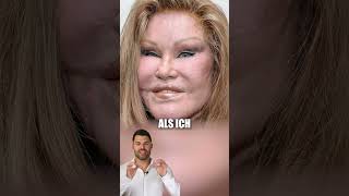 Jocelyn Wildenstein Die Katzenfrau 😱jocelynwildenstein katzenfrau frühervsheute beautydoc [upl. by Emlen]