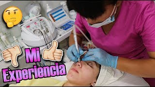 MI EXPERIENCIA PEELING FACIAL con PUNTA DE DIAMANTEMICRODERMOABRASIÓNMASAJE RELAJANTEVico [upl. by Hodosh259]