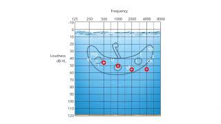 The First Audiogram Moderate [upl. by Kerin166]