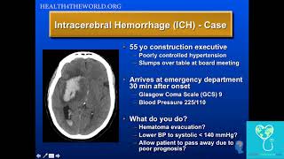 Intracerebral Hemorrhage Case Study  Health4TheWorld Academy [upl. by Berglund]