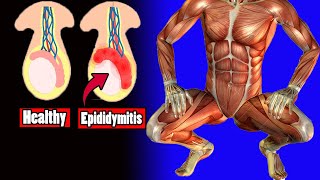 eppididymits exercises [upl. by Tudela]