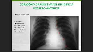 Radiología  Anatomía del Corazón y Grandes Vasos 11 [upl. by Naihtniroc]