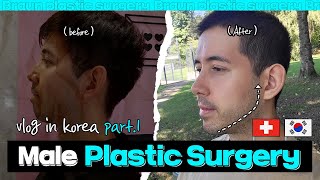 Male plastic surgery in Korea │Genioplasty Shaving jawline Facial liposuction [upl. by Nolita539]