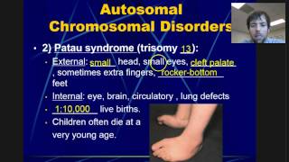 Chromosomal Disorders [upl. by Milan]