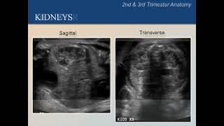 Ultrasound Training Course 05 part 2 [upl. by Mlehliw]