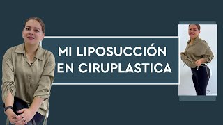 Testimonio de liposucción Ciruplastica 😍 [upl. by Narra]