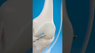 How doctor treat the ligament problem shorts goodscience [upl. by Bausch589]