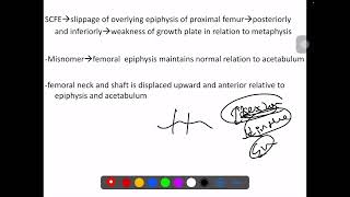 SCFE SLIPPED CAPITO FEMORAL EPIPHYSIS [upl. by Akialam]