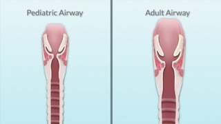 Pediatric Airway Assessment by T Miller  OPENPediatrics [upl. by Woodcock]