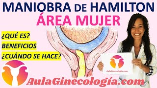 MANIOBRA DE HAMILTON🤰🏻 QUÉ ES BENEFICIOS CUÁNDO SE HACE RIESGOS  Ginecología y Obstetricia [upl. by Aikimat667]