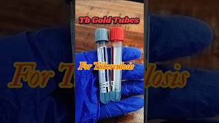 Tb Gold TubesTb Gold sample collection tubesTuberculosis test youtubeshorts shorts tranding [upl. by Arin821]