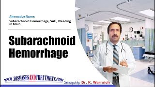 Subarachnoid Hemorrhage  Causes Diagnosis Symptoms Treatment Prognosis [upl. by Desimone341]