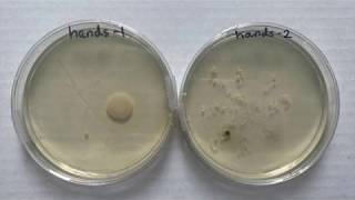 Germs amp Bacteria Agar Plate Observations [upl. by Ellimahs990]