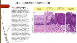 Cenni di biologia del cancro [upl. by Engenia]