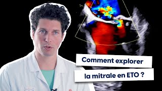 Comment explorer la mitrale en ETO [upl. by Adaline]