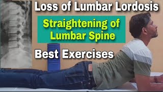 Loss of Lumbar Lordosis Exercises in Hindi  Straightening of Lumbar Spine  Spine Curvature [upl. by Darrill]