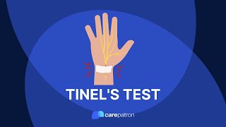 Tinels Test [upl. by Nirag683]