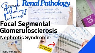 focal segmental glomerulosclerosis  nephrotic syndrome  renal pathology  selflessmedicose [upl. by Eceinaj]