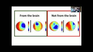 Criteria for Identifying Interictal Epileptiform Discharges Sándor Beniczky CairoNeuro 2022 [upl. by Portie447]