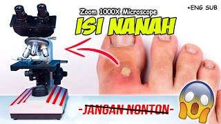 INILAH ISI NANAH DI MIKROSKOP  Pus Under Microscope Zoom 1000X [upl. by Llemmart]