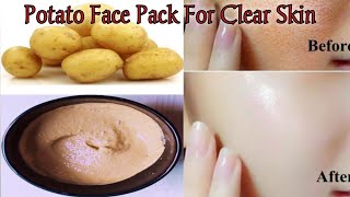 Potato Face Pack For Skin Whitening How to Get Spotless Glowing amp Fair Skin Potato Face Mask [upl. by Aenad]