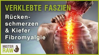 Verklebte Faszien  Rückenschmerzen  Aufbissschiene Im Kiefer Fibromyalgie therapieren [upl. by Thorn]