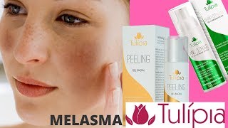 CLAREAMENTO DE PELE COM A LINHA TULIPIA PARTE 01  MELASMA TRATAMENTO QUE FUNCIONA [upl. by Artened]