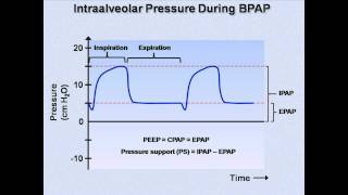 NonInvasive Positive Pressure Ventilation Mechanical Ventilation  Lecture 6 [upl. by Ennaear805]