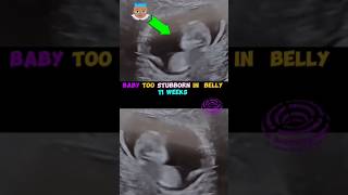 Baby boy ultrasound  Too much kicks pregnancy baby babyboy weekspregnant 3 [upl. by Yromem42]