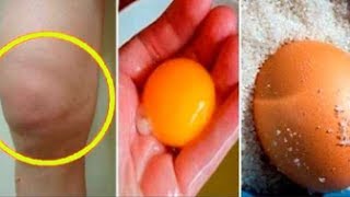 Eliminate knee inflammation and pain with egg and salt home remedy [upl. by Rebmyt]