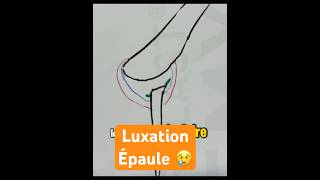 Luxation épaule shoulderinjury anatomy [upl. by Casavant]