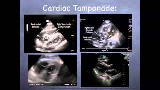 Tutorial Basic echocardiography [upl. by Arne]