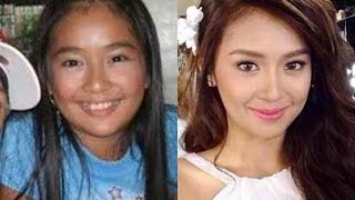 Kathryn Bernardo Before And After [upl. by Hilly]