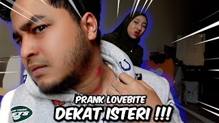 PRANK LOVEBITE  PEREMPUAN MANA BUAT NI [upl. by Richers]