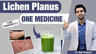 One Medicine To Cure Lichen Planus Skin Disease Naturally amp Permanent Results From First Week [upl. by Edorej286]