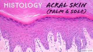 Skin Histology Acral Skin aka glabrous skin of palm of hand amp sole of foot [upl. by Sinnard70]