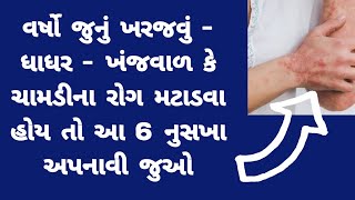 દાદર  ખરજવું  ખંજવાળ  ખસખસનો 100 ઈલાજ । Kharajvu desi upchar । Fit Gujarat Mission [upl. by Atilef226]