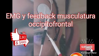 feedback con electromiografia de superficie en musculatura facial [upl. by Udell]