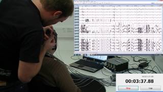 EEG speed mounting 64 channels in 5 minutes and 54 seconds including quality check [upl. by Merrow]