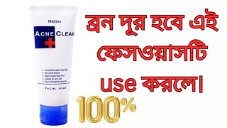 Mistine Acne Clear Facial Foam Face WashMistine Acne Clear Face Wash reviewhow to useBangla [upl. by Raddi]