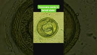 ➡️ Toxocara canis in larva state microbiology parasite [upl. by Hintze851]