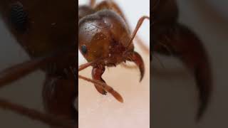 Fire ant bite and sting upclose [upl. by Jemimah]