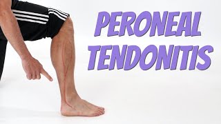 Peroneal Tendonitis Side of Foot Pain Causes amp SelfTreatment [upl. by Johan]