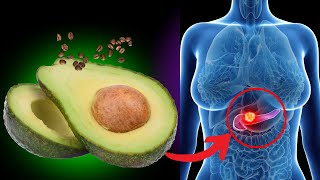 Comer aguacate durante 30 días lo hace por tu cuerpo  Top 10 beneficios [upl. by Radmen]